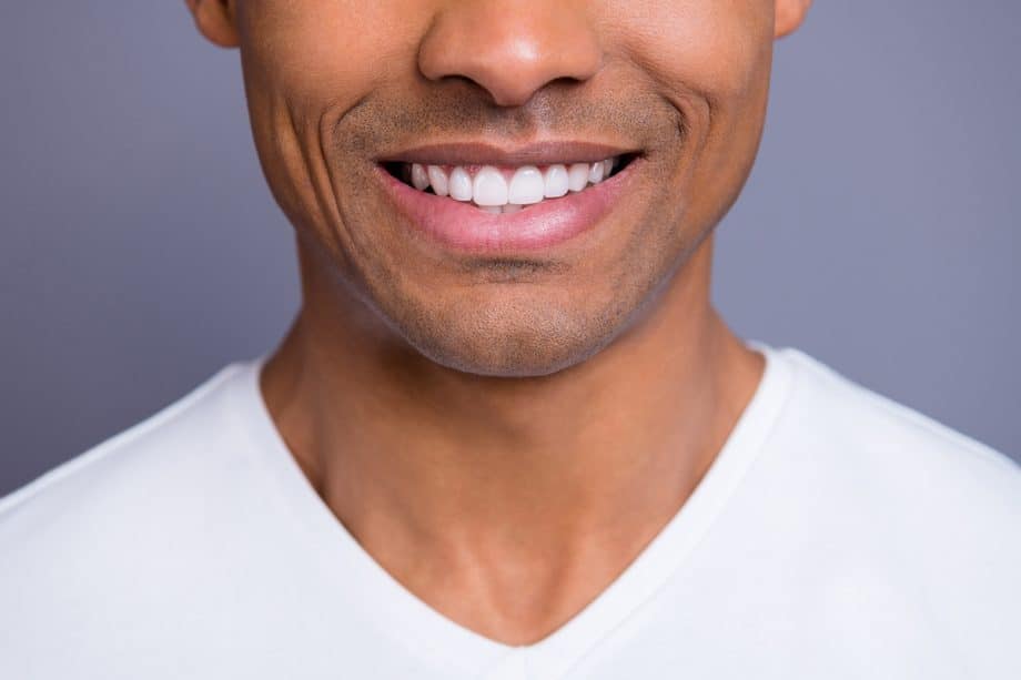 3 Options for Whitening Your Teeth