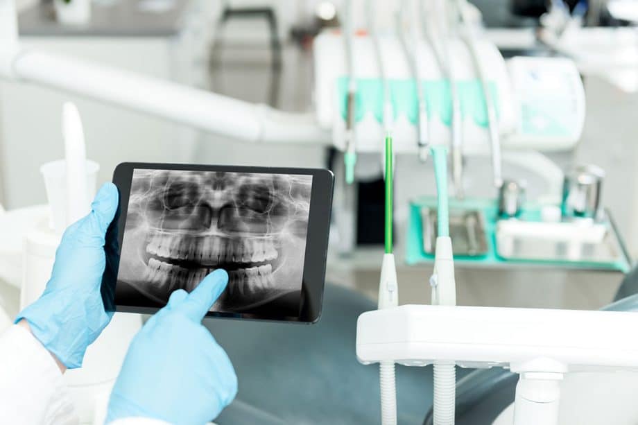 AI X-ray Analysis is Transforming Dentistry